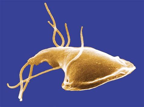  Giardia:  Een microscopische kampioen in darmparasieten!