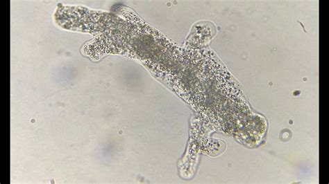 Opercularia! Een Microscopische Wonderwereld Van Amoeboide Bewegingen En Pseudopoden-Activiteiten